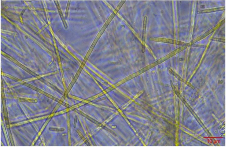 Photo de Conférence “Les Cyanobactéries, toxiques mais pas que !” (Fête de la Science)